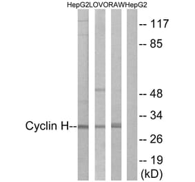 Western Blot - Anti-Cyclin H Antibody (B0881) - Antibodies.com