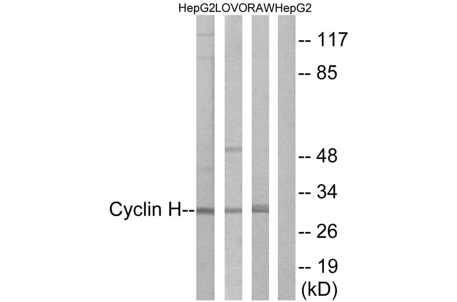 Western Blot - Anti-Cyclin H Antibody (B0881) - Antibodies.com