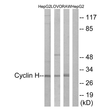 Western Blot - Anti-Cyclin H Antibody (B0881) - Antibodies.com