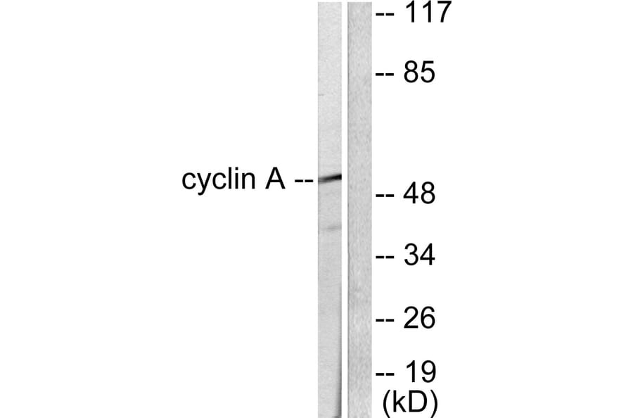 Western Blot - Anti-Cyclin A Antibody (C0165) - Antibodies.com