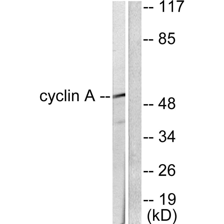 Western Blot - Anti-Cyclin A Antibody (C0165) - Antibodies.com