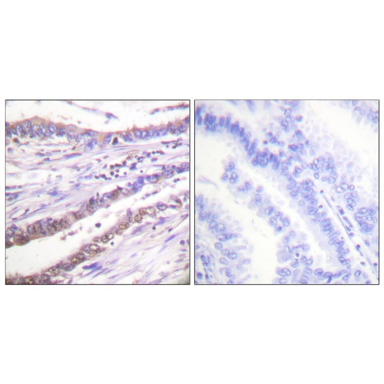 Immunohistochemistry - Anti-Cyclin A Antibody (C0165) - Antibodies.com