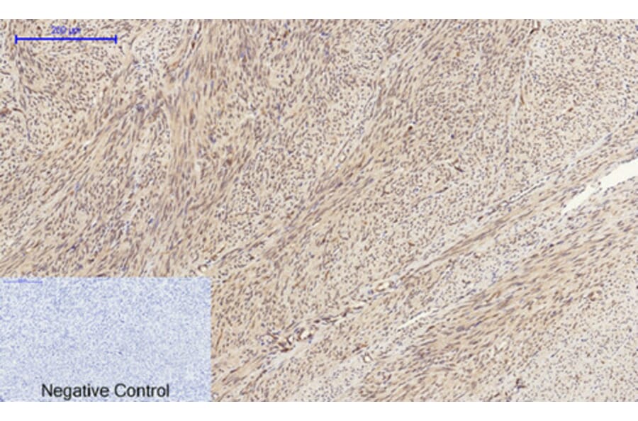 Immunohistochemistry - Anti-Cyclin A Antibody (C0165) - Antibodies.com