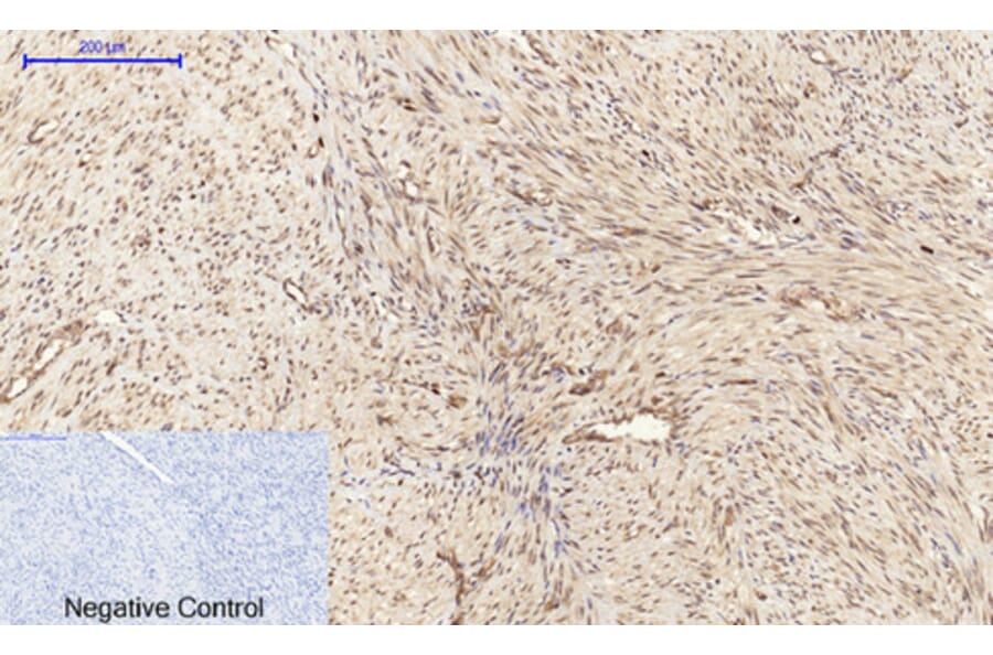Immunohistochemistry - Anti-Cyclin A Antibody (C0165) - Antibodies.com