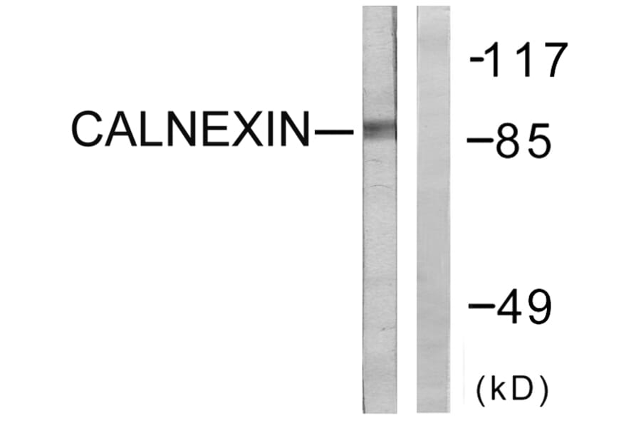 Western Blot - Anti-Calnexin Antibody (B0463) - Antibodies.com