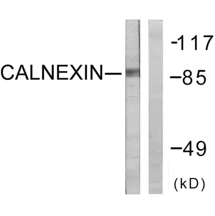 Western Blot - Anti-Calnexin Antibody (B0463) - Antibodies.com