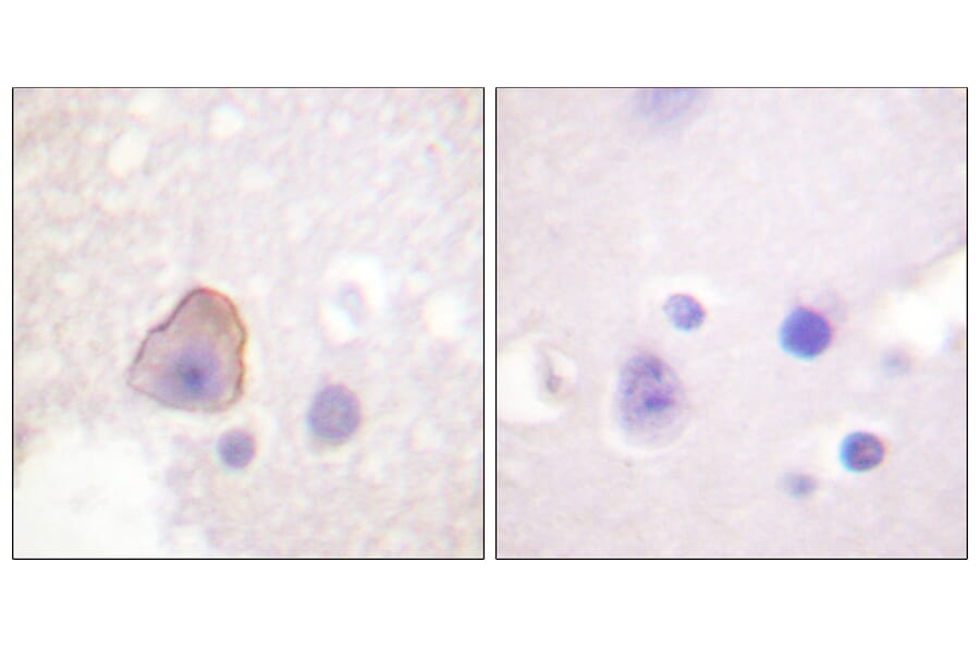 Immunohistochemistry - Anti-ADD1 Antibody (B0002) - Antibodies.com