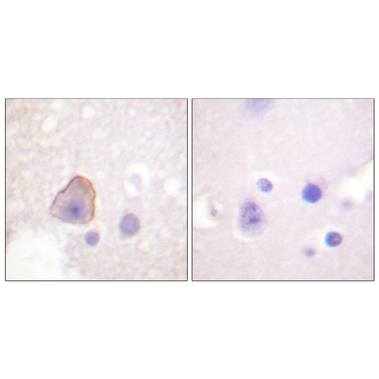 Immunohistochemistry - Anti-ADD1 Antibody (B0002) - Antibodies.com