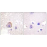 Immunohistochemistry - Anti-ADD1 Antibody (B0002) - Antibodies.com