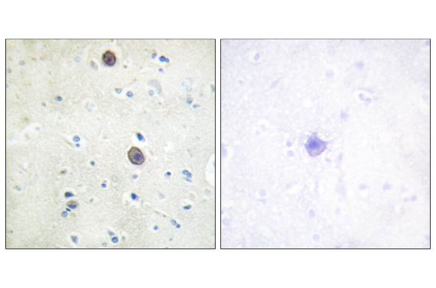 Immunohistochemistry - Anti-Amyloid beta A4 (phospho Thr743 + Thr668) Antibody (A0004) - Antibodies.com