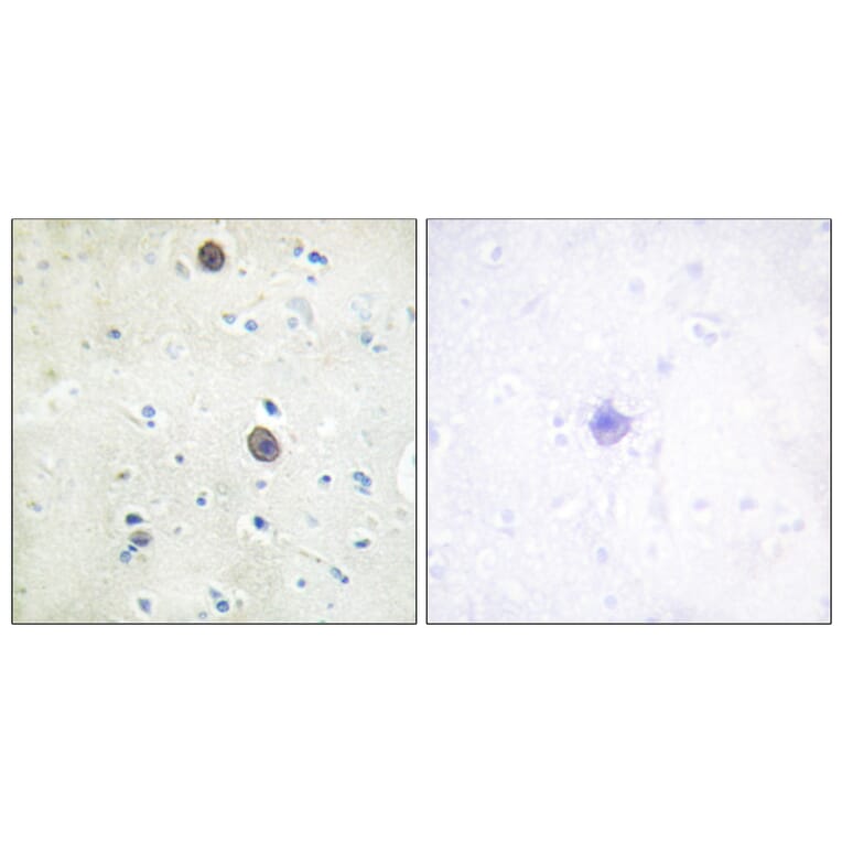 Immunohistochemistry - Anti-Amyloid beta A4 (phospho Thr743 + Thr668) Antibody (A0004) - Antibodies.com