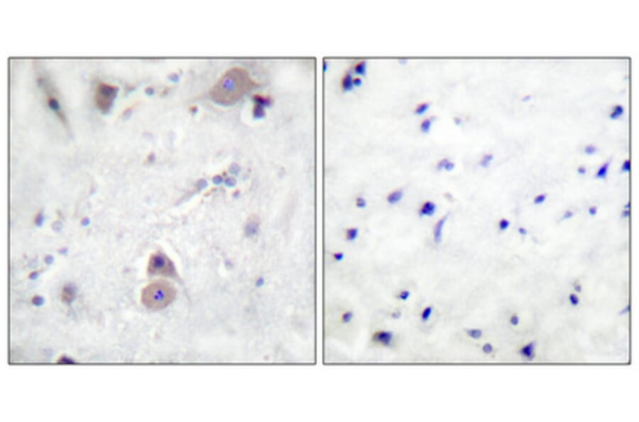 Immunohistochemistry - Anti-Amyloid beta A4 (phospho Thr743 + Thr668) Antibody (A0004) - Antibodies.com