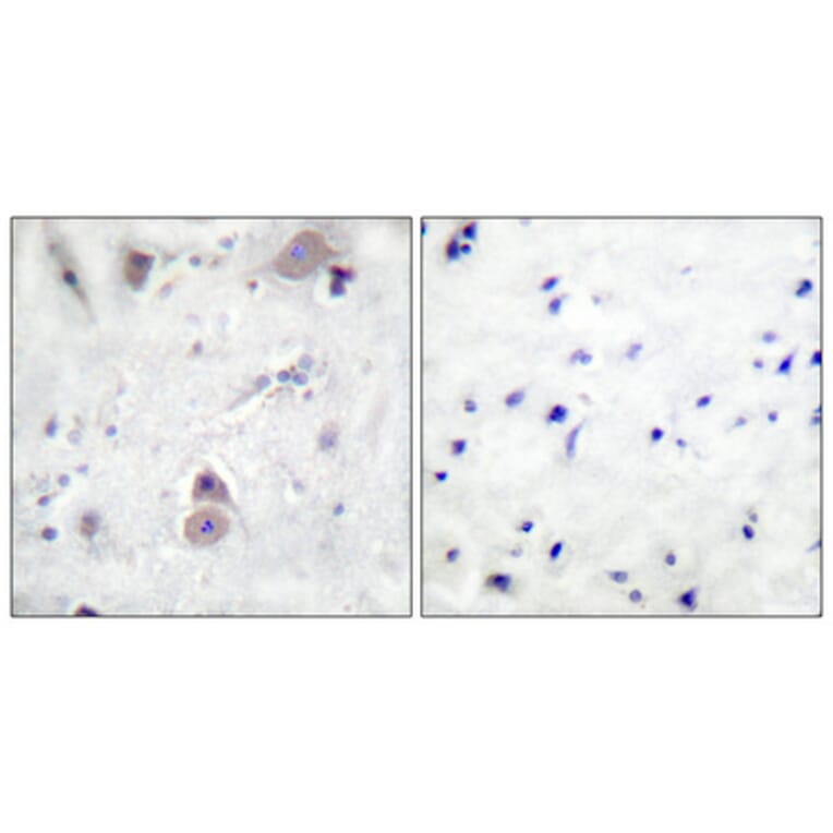 Immunohistochemistry - Anti-Amyloid beta A4 (phospho Thr743 + Thr668) Antibody (A0004) - Antibodies.com