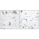 Immunohistochemistry - Anti-Amyloid beta A4 (phospho Thr743 + Thr668) Antibody (A0004) - Antibodies.com
