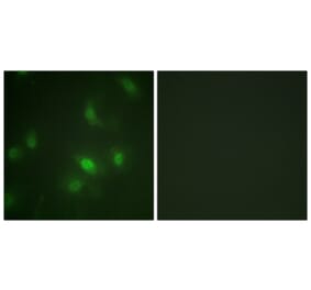 Immunofluorescence - Anti-STAT5A + STAT5B (phospho Ser725 + Ser730) Antibody (A1008) - Antibodies.com