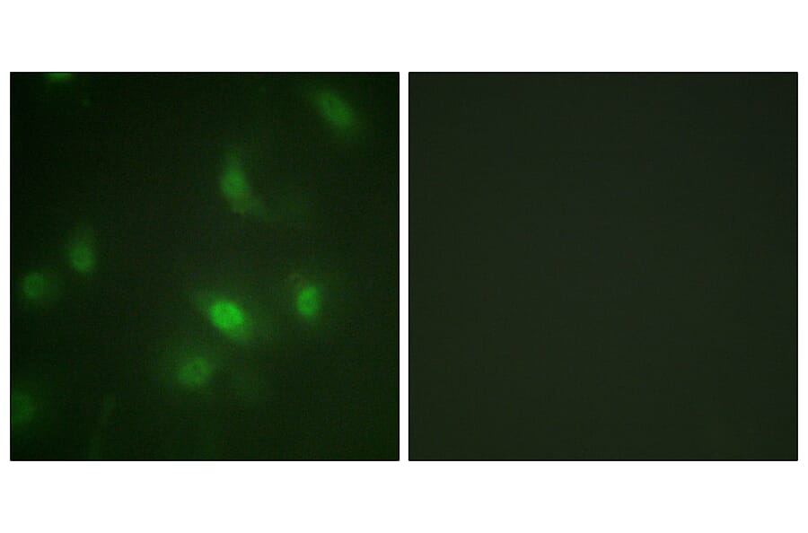 Immunofluorescence - Anti-STAT5A + STAT5B (phospho Ser725 + Ser730) Antibody (A1008) - Antibodies.com