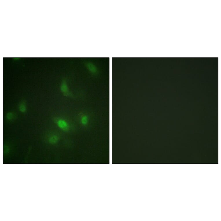 Immunofluorescence - Anti-STAT5A + STAT5B (phospho Ser725 + Ser730) Antibody (A1008) - Antibodies.com