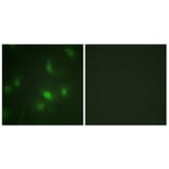 Immunofluorescence - Anti-STAT5A + STAT5B (phospho Ser725 + Ser730) Antibody (A1008) - Antibodies.com