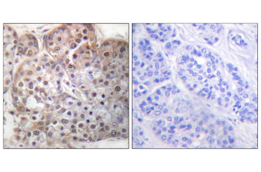 Immunohistochemistry - Anti-STAT5A + STAT5B (phospho Ser725 + Ser730) Antibody (A1008) - Antibodies.com