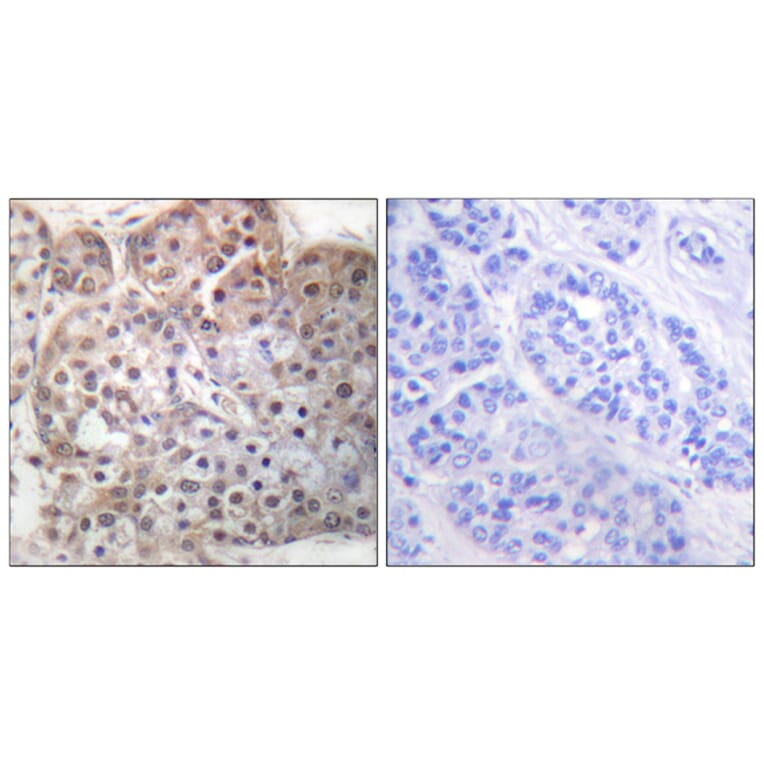 Immunohistochemistry - Anti-STAT5A + STAT5B (phospho Ser725 + Ser730) Antibody (A1008) - Antibodies.com