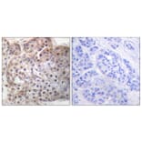 Immunohistochemistry - Anti-STAT5A + STAT5B (phospho Ser725 + Ser730) Antibody (A1008) - Antibodies.com