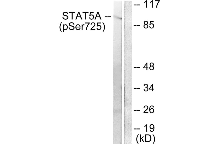 Western Blot - Anti-STAT5A + STAT5B (phospho Ser725 + Ser730) Antibody (A1008) - Antibodies.com