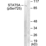 Western Blot - Anti-STAT5A + STAT5B (phospho Ser725 + Ser730) Antibody (A1008) - Antibodies.com