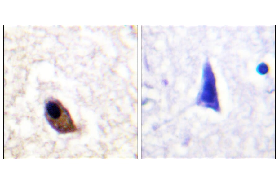 Immunohistochemistry - Anti-NMDAR2A + NMDAR2B (phospho Tyr1246 + Tyr1252) Antibody (A0959) - Antibodies.com