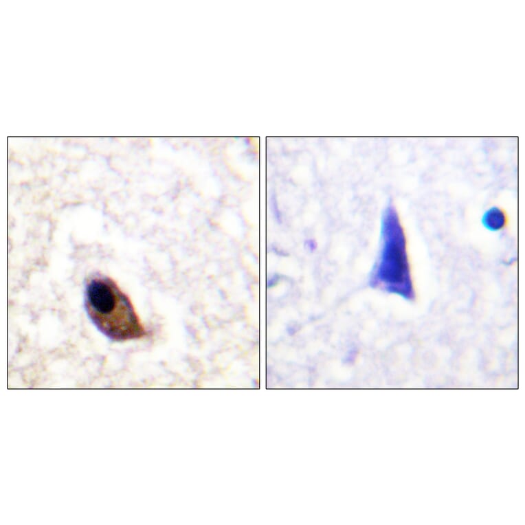 Immunohistochemistry - Anti-NMDAR2A + NMDAR2B (phospho Tyr1246 + Tyr1252) Antibody (A0959) - Antibodies.com
