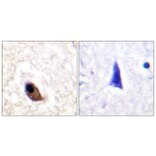 Immunohistochemistry - Anti-NMDAR2A + NMDAR2B (phospho Tyr1246 + Tyr1252) Antibody (A0959) - Antibodies.com
