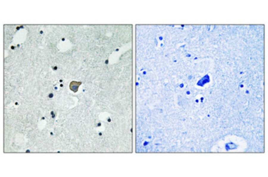 Immunohistochemistry - Anti-NMDAR2A + NMDAR2B (phospho Tyr1246 + Tyr1252) Antibody (A0959) - Antibodies.com