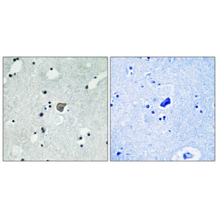 Immunohistochemistry - Anti-NMDAR2A + NMDAR2B (phospho Tyr1246 + Tyr1252) Antibody (A0959) - Antibodies.com