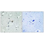 Immunohistochemistry - Anti-NMDAR2A + NMDAR2B (phospho Tyr1246 + Tyr1252) Antibody (A0959) - Antibodies.com