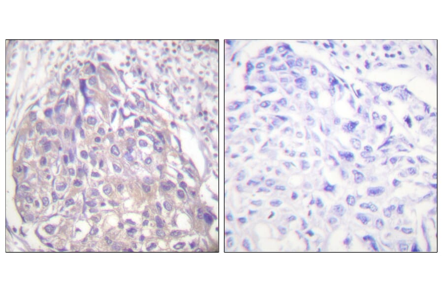 Immunohistochemistry - Anti-FOXO1 + FOXO3 + FOXO4 (phospho Thr24 + Thr32) Antibody (A0483) - Antibodies.com
