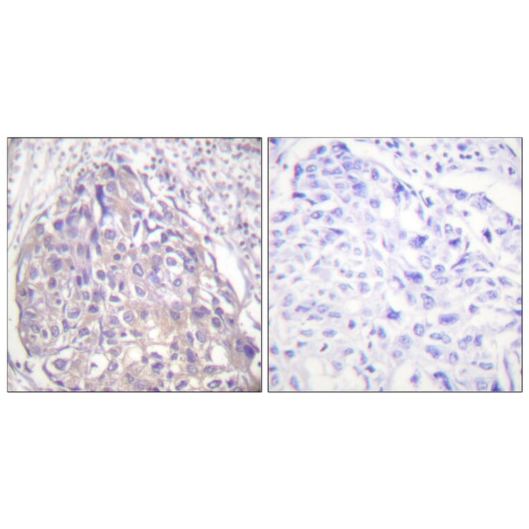 Immunohistochemistry - Anti-FOXO1 + FOXO3 + FOXO4 (phospho Thr24 + Thr32) Antibody (A0483) - Antibodies.com