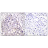 Immunohistochemistry - Anti-FOXO1 + FOXO3 + FOXO4 (phospho Thr24 + Thr32) Antibody (A0483) - Antibodies.com