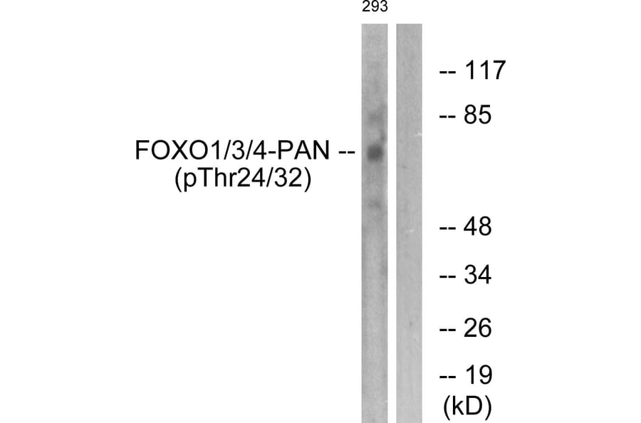 Western Blot - Anti-FOXO1 + FOXO3 + FOXO4 (phospho Thr24 + Thr32) Antibody (A0483) - Antibodies.com
