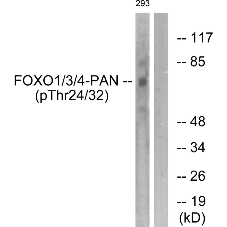 Western Blot - Anti-FOXO1 + FOXO3 + FOXO4 (phospho Thr24 + Thr32) Antibody (A0483) - Antibodies.com