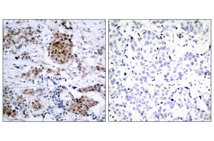 Immunohistochemistry - Anti-Estrogen Receptor-alpha (phospho Ser167) Antibody (A7078) - Antibodies.com