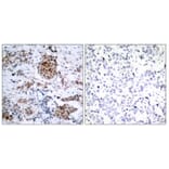 Immunohistochemistry - Anti-Estrogen Receptor-alpha (phospho Ser167) Antibody (A7078) - Antibodies.com