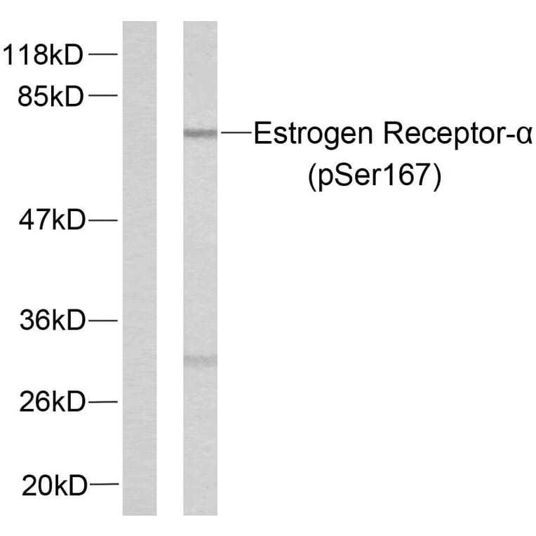 Western Blot - Anti-Estrogen Receptor-alpha (phospho Ser167) Antibody (A7078) - Antibodies.com