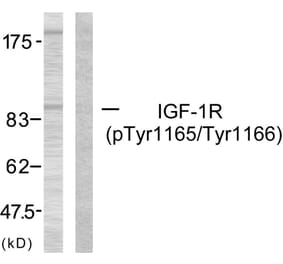 Western Blot - Anti-IGF1R (phospho Tyr1165 + Tyr1166) Antibody (A7115) - Antibodies.com