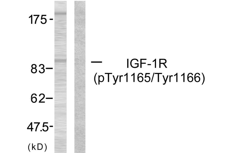 Western Blot - Anti-IGF1R (phospho Tyr1165 + Tyr1166) Antibody (A7115) - Antibodies.com
