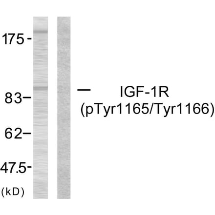 Western Blot - Anti-IGF1R (phospho Tyr1165 + Tyr1166) Antibody (A7115) - Antibodies.com