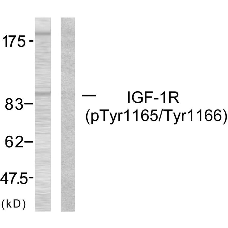 Western Blot - Anti-IGF1R (phospho Tyr1165 + Tyr1166) Antibody (A7115) - Antibodies.com