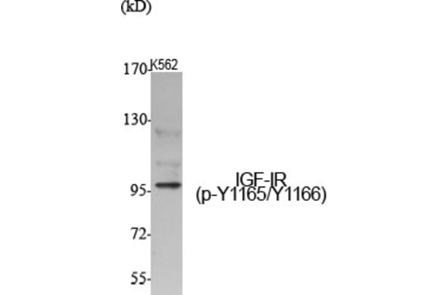 Western Blot - Anti-IGF1R (phospho Tyr1165 + Tyr1166) Antibody (A7115) - Antibodies.com