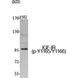 Western Blot - Anti-IGF1R (phospho Tyr1165 + Tyr1166) Antibody (A7115) - Antibodies.com