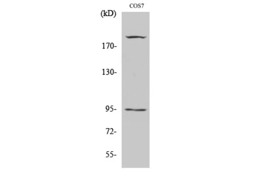 Western Blot - Anti-IGF1R (phospho Tyr1165 + Tyr1166) Antibody (A7115) - Antibodies.com