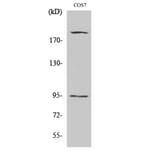 Western Blot - Anti-IGF1R (phospho Tyr1165 + Tyr1166) Antibody (A7115) - Antibodies.com