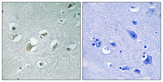 Immunohistochemical analysis of paraffin-embedded human brain using Anti-MLK1 + MLK2 (phospho Thr312 + Thr266) Antibody. The right hand panel represents a negative control, where the antibody was pre-incubated with the immunising peptide.